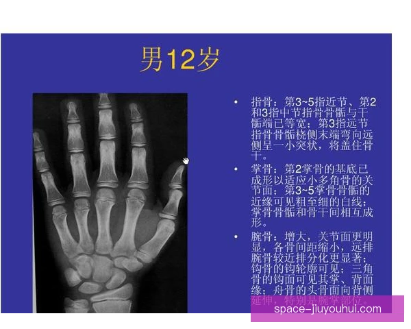 雪上技巧骨龄评估，青少年选材与训练负荷需精准